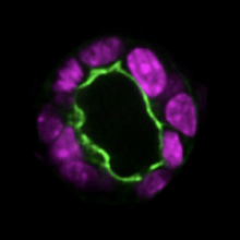 The Hidden Mechanics of Lumen Formation: Unlocking the Secrets of Biological "Active Balloons"